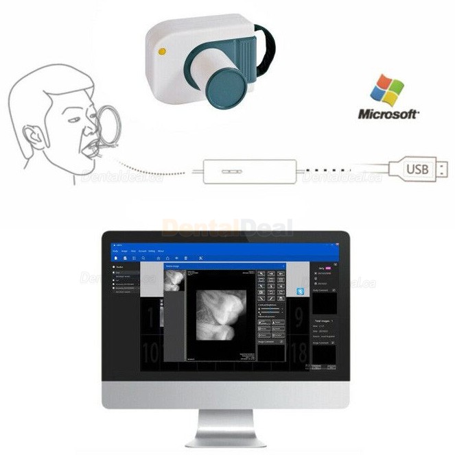 Dental X-Ray Sensor Intraoral RVG Sensor VXS2121/2530 Dental X-Ray Sensor Intraoral RVG Sensor VXS2121/2530