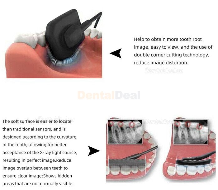 Dental X-Ray Sensor Intraoral RVG Sensor VXS2121/2530 Dental X-Ray Sensor Intraoral RVG Sensor VXS2121/2530