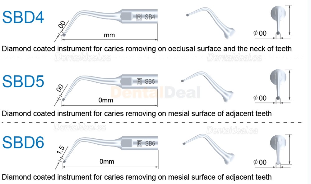 5Pcs Refine&reg; Cavity Preparation Ultrasonic Tips SBD1 SBD2 SBD3 SBD4 SBD5/6 SBDR SBDL SBD7L SBD7R Fit Satelec NSK DTE