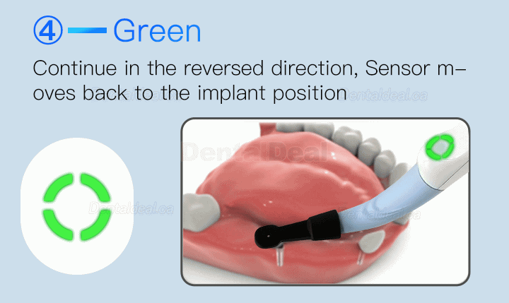 Dental Implant Locator Smart Implant Finder Implant Detector Three-dimesonal Sensor