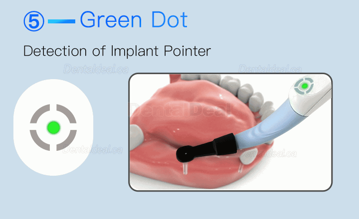 Dental Implant Locator Smart Implant Finder Implant Detector Three-dimesonal Sensor