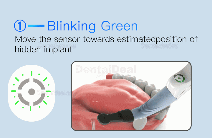 Dental Implant Locator Smart Implant Finder Implant Detector Three-dimesonal Sensor
