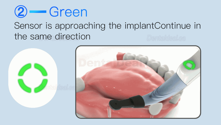 Dental Implant Locator Smart Implant Finder Implant Detector Three-dimesonal Sensor