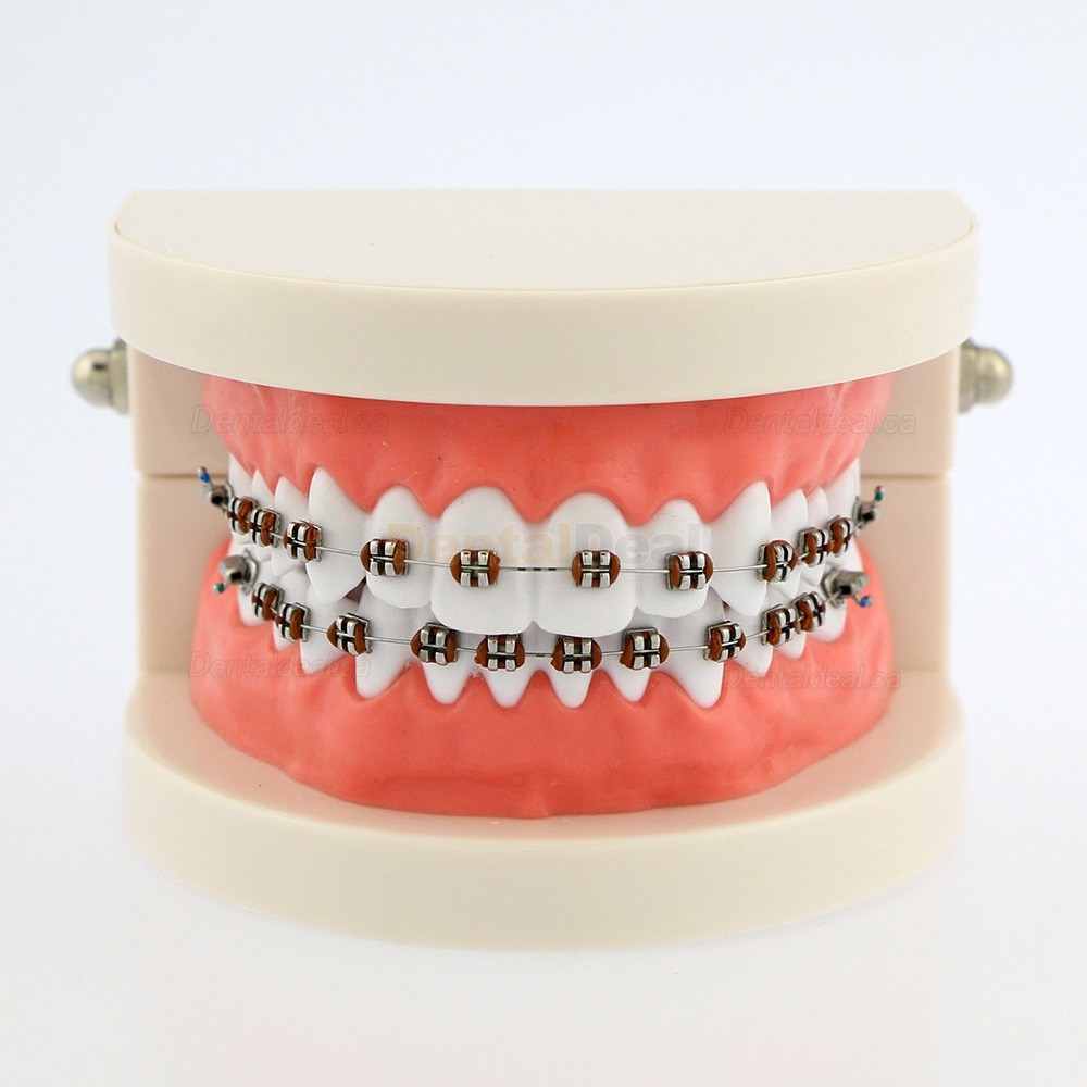 Dental Demonstration Teeth Model with Braces For Patient Education 5006