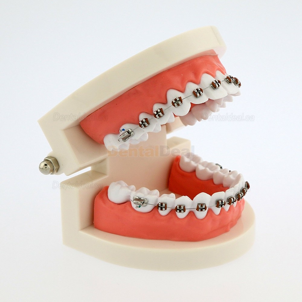 Dental Demonstration Teeth Model with Braces For Patient Education 5006