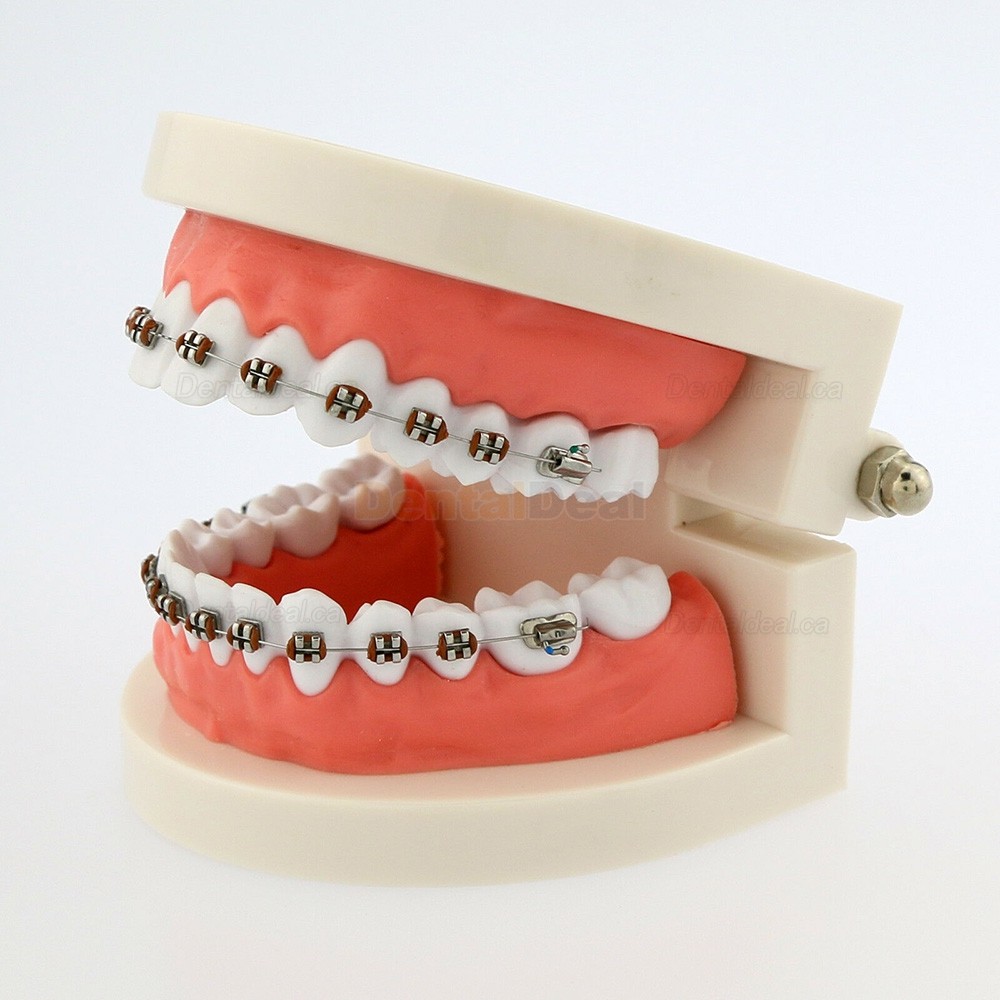 Dental Demonstration Teeth Model with Braces For Patient Education 5006