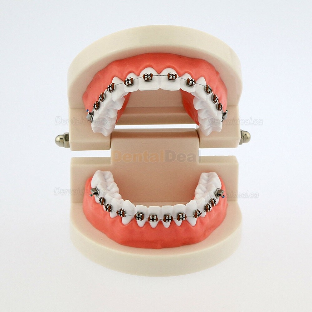 Dental Demonstration Teeth Model with Braces For Patient Education 5006