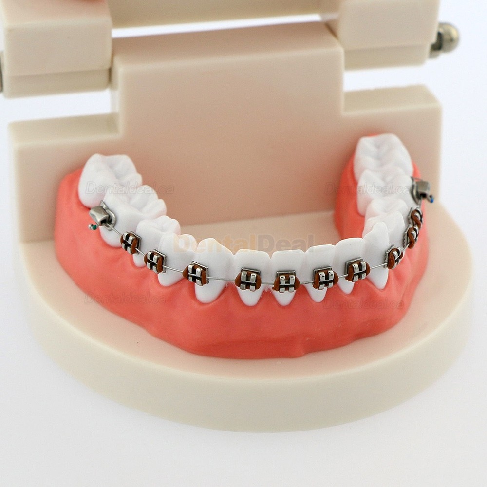 Dental Demonstration Teeth Model with Braces For Patient Education 5006