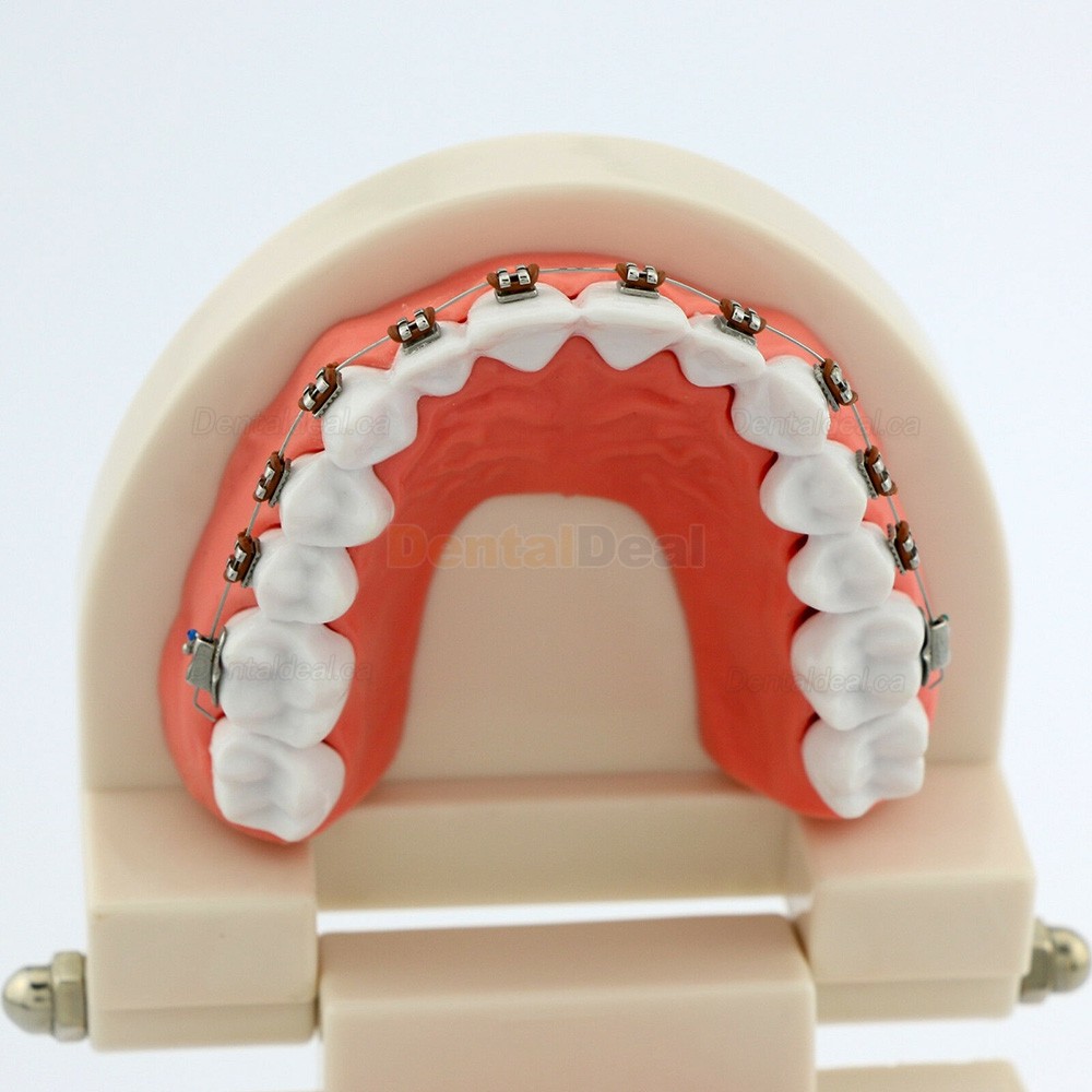 Dental Demonstration Teeth Model with Braces For Patient Education 5006