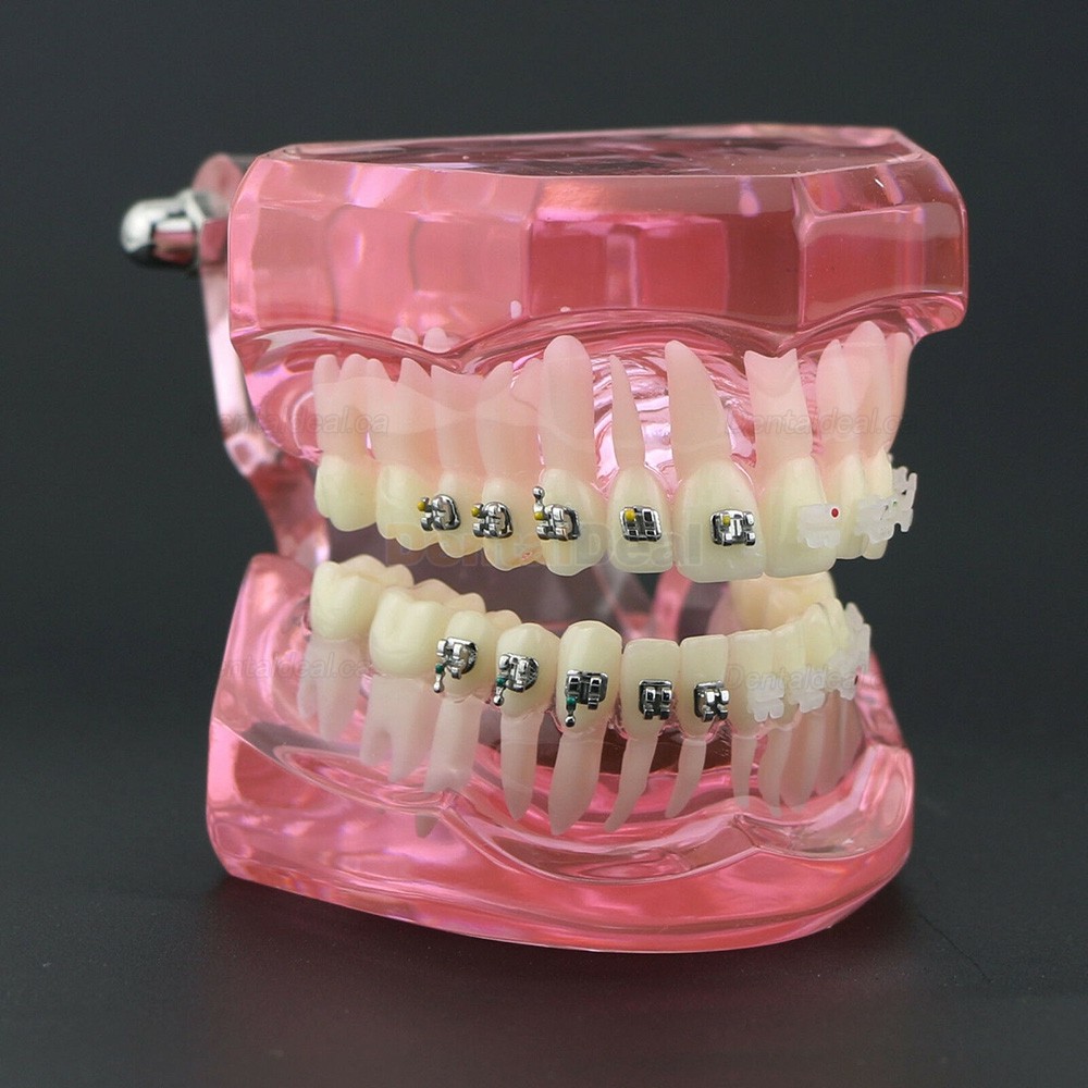 Orthodontic Teeth Model with Metal and Ceramic Bracket Braces Dental Study Training Model 3003