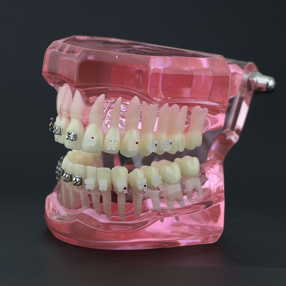 Orthodontic Teeth Model with Metal and Ceramic Bracket Braces Dental Study Training Model 3003