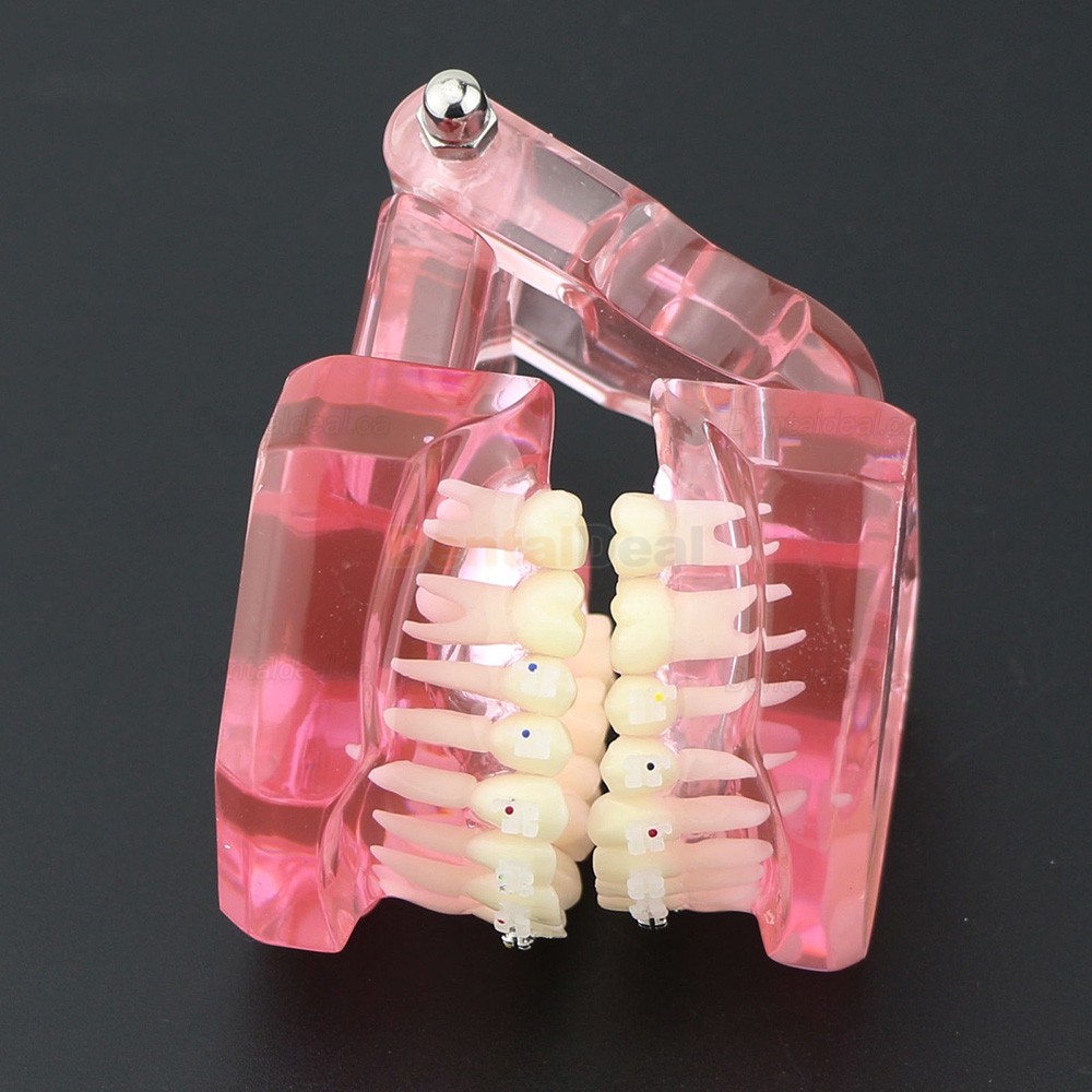 Orthodontic Teeth Model with Metal and Ceramic Bracket Braces Dental Study Training Model 3003