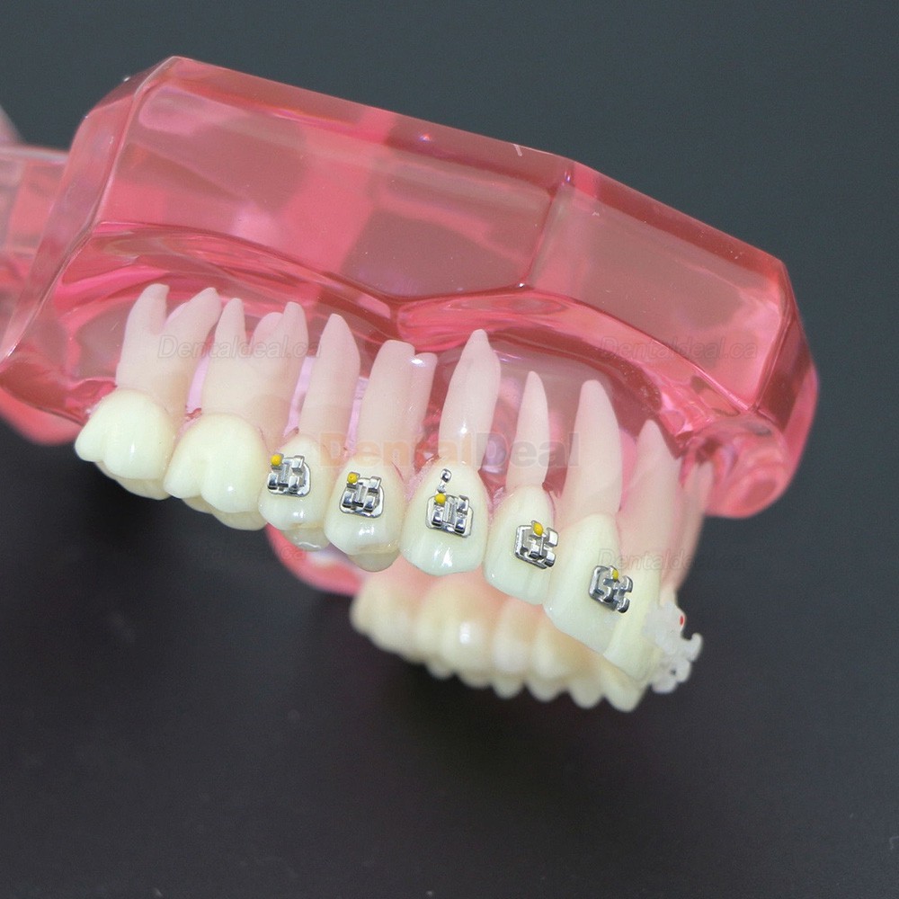 Orthodontic Teeth Model with Metal and Ceramic Bracket Braces Dental Study Training Model 3003