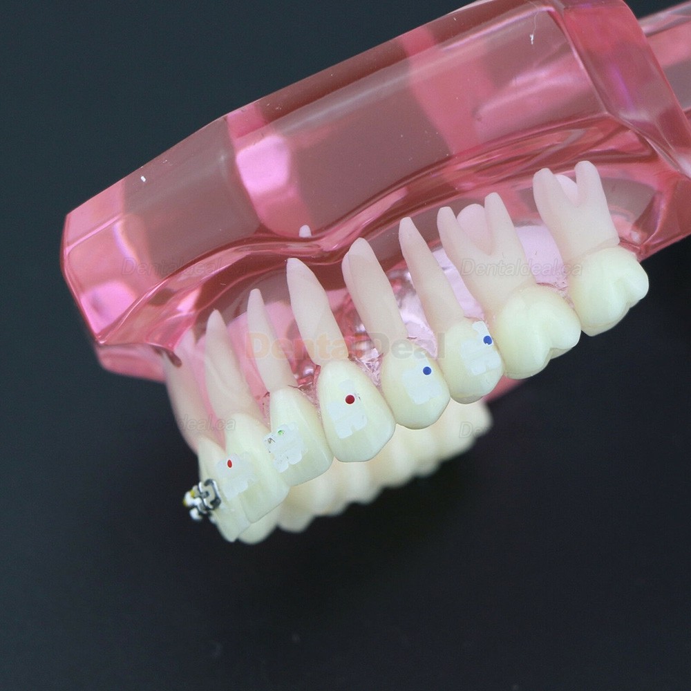 Orthodontic Teeth Model with Metal and Ceramic Bracket Braces Dental Study Training Model 3003