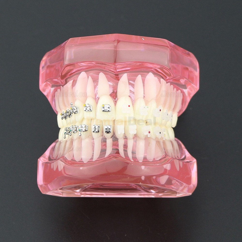 Orthodontic Teeth Model with Metal and Ceramic Bracket Braces Dental Study Training Model 3003
