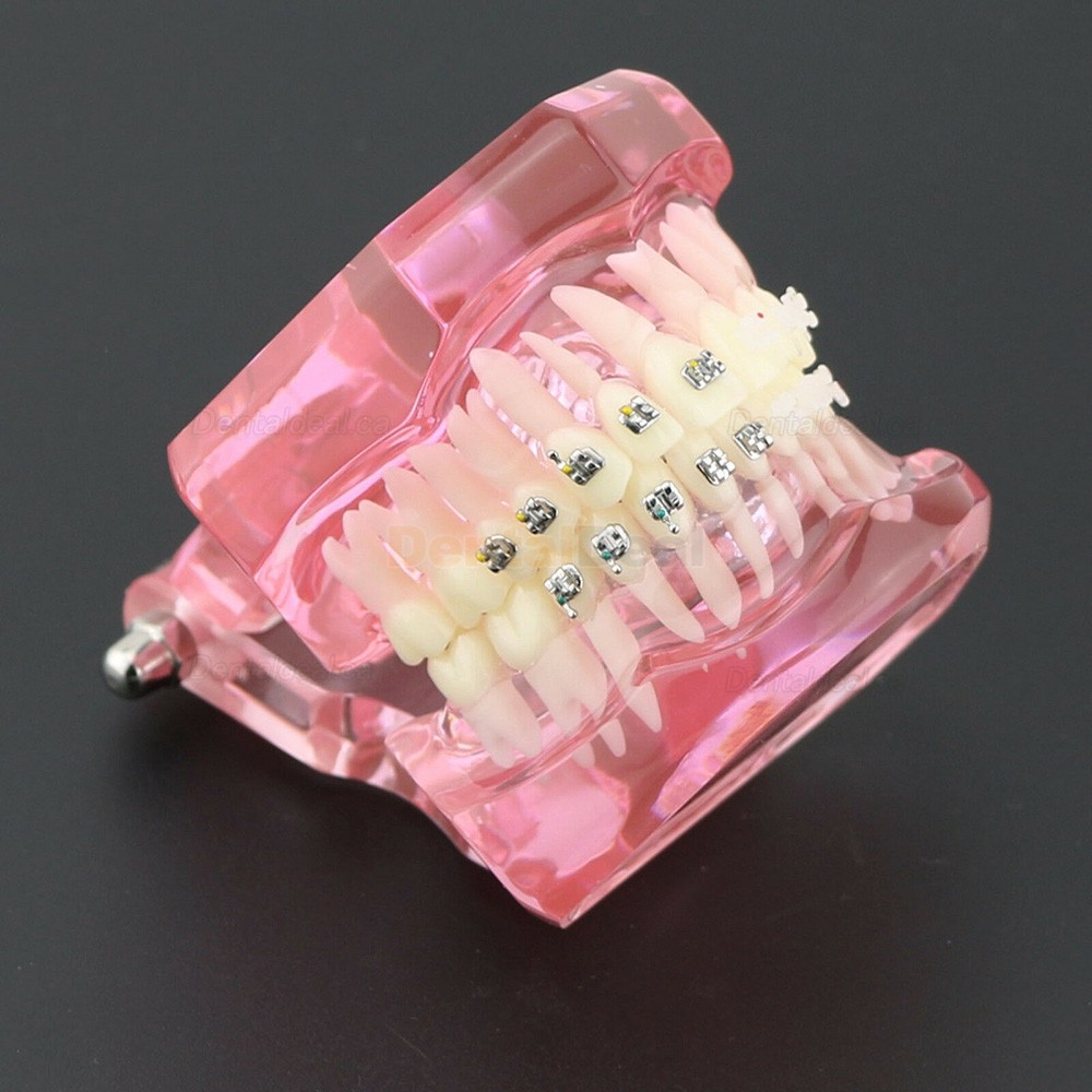Orthodontic Teeth Model with Metal and Ceramic Bracket Braces Dental Study Training Model 3003
