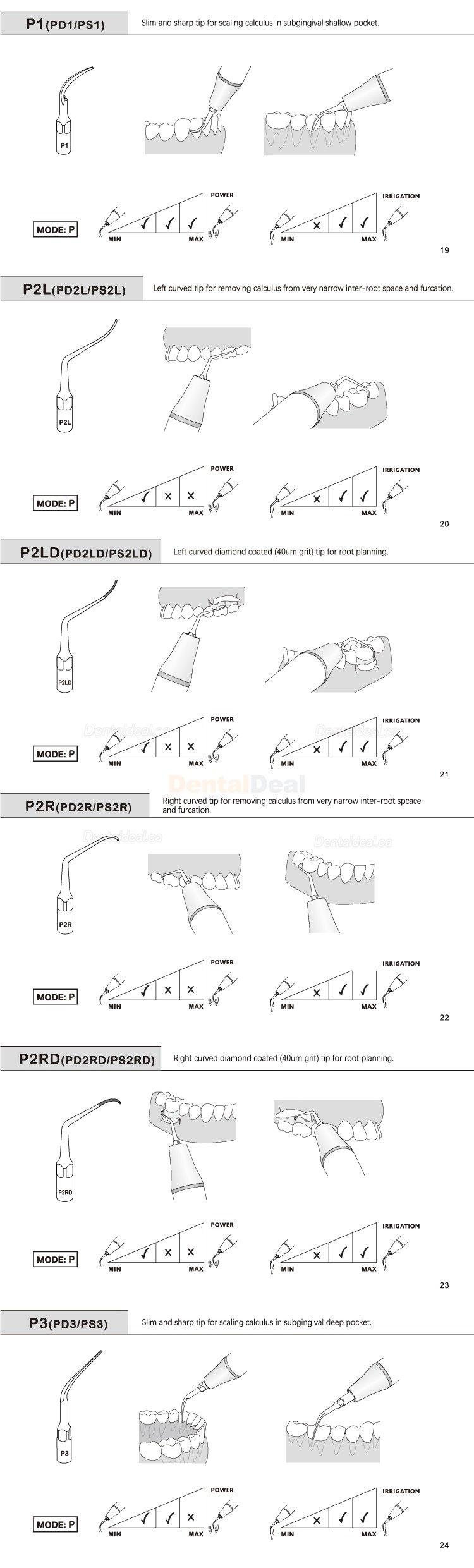 5Pcs Refine&reg; Ultrasonic Perio Scaler Tips P2L P2R P2LD P2RD P5 P6 P7 P8 P10 P11 P12 P14L Fit EMS Woodpecker