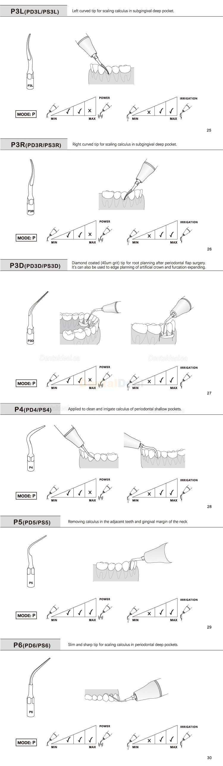 5Pcs Refine&reg; Ultrasonic Perio Scaler Tips P2L P2R P2LD P2RD P5 P6 P7 P8 P10 P11 P12 P14L Fit EMS Woodpecker