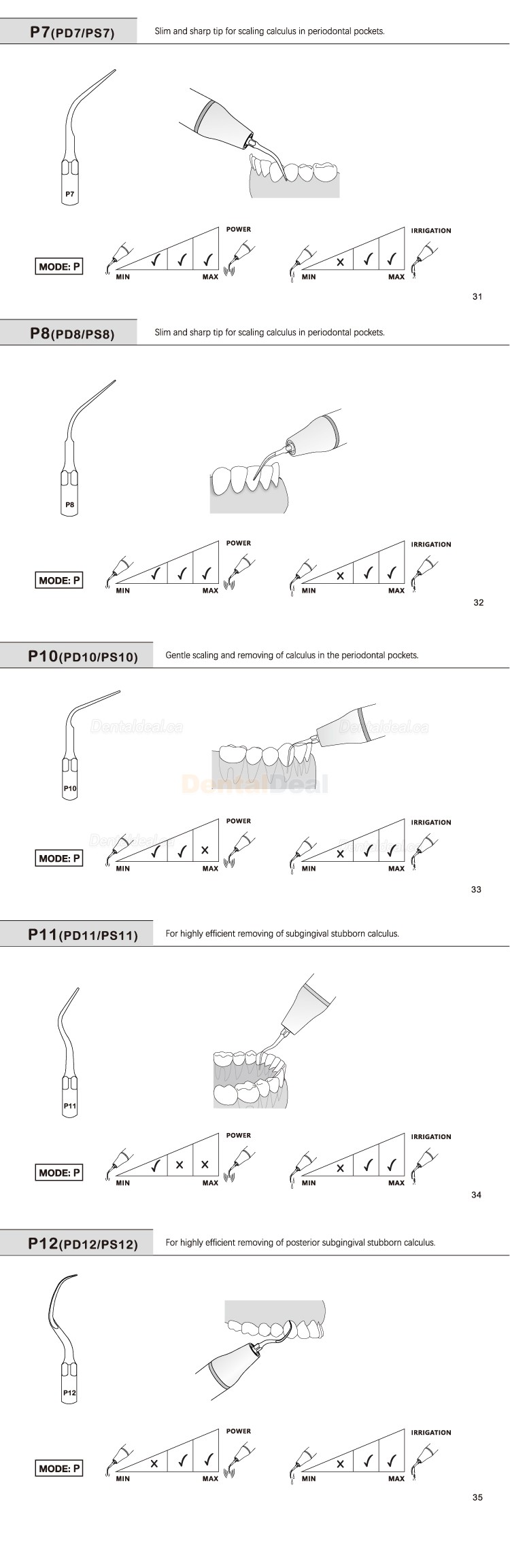 5Pcs Refine&reg; Ultrasonic Perio Scaler Tips P2L P2R P2LD P2RD P5 P6 P7 P8 P10 P11 P12 P14L Fit EMS Woodpecker