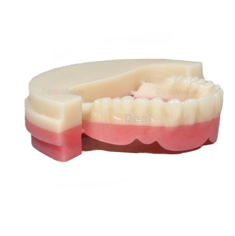 5Pcs Dental Lab PMMA Blocks PMMA Disk CAD/CAM Material OD98*25mm