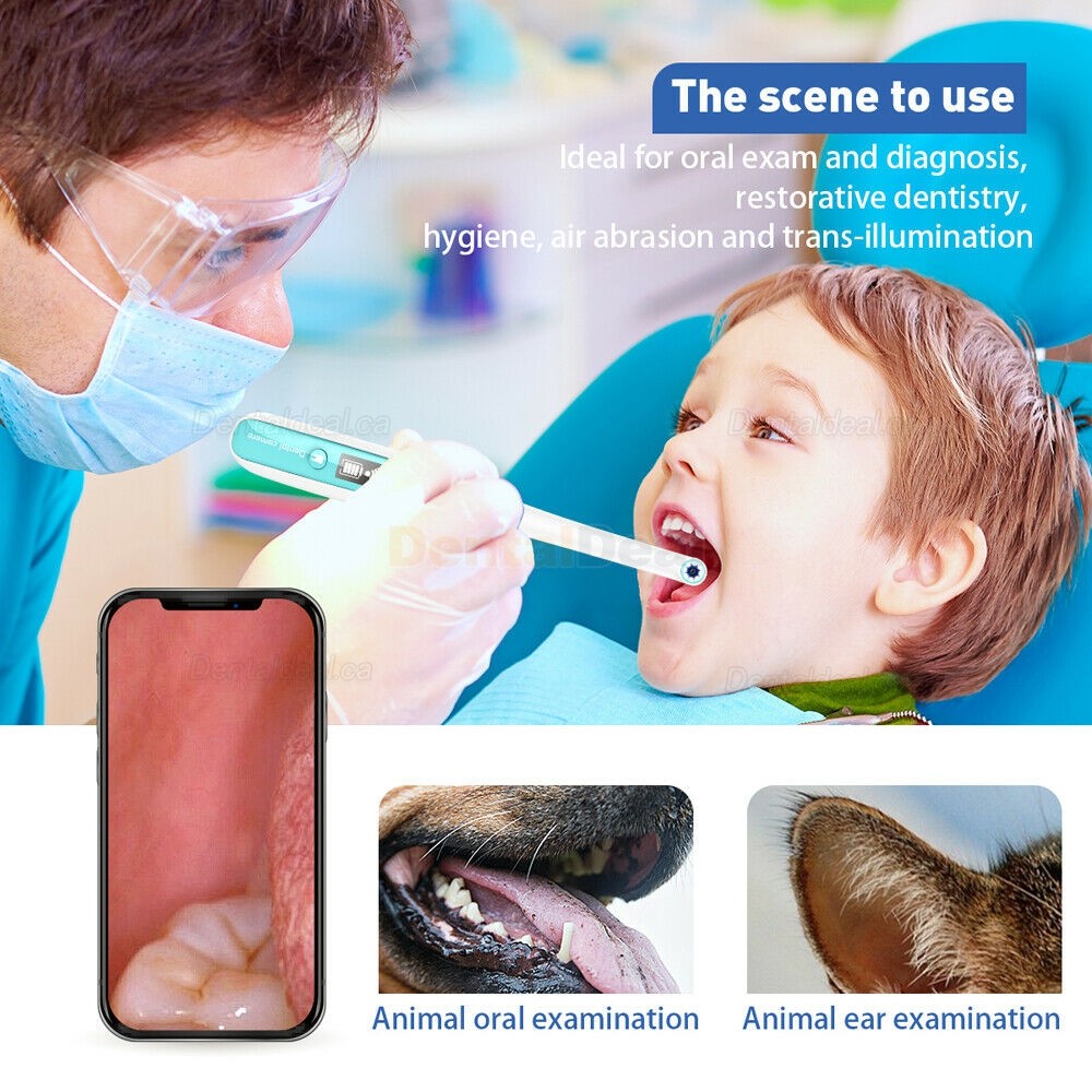 Dental Wifi Intraoral Camera HD Wireless for Android / iOS / Tablet IP67