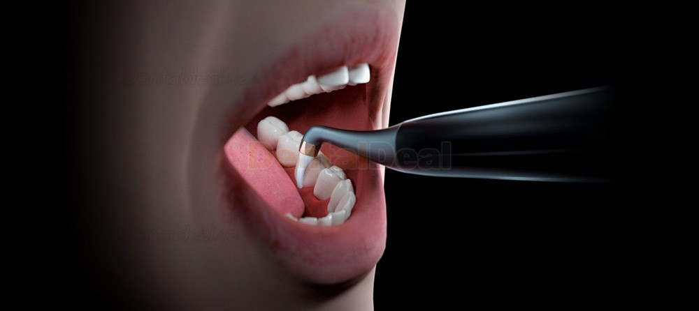 Woodpecker AP-H Plus Dental Air Flow Polisher Supragingival / Subgingival 4Hole