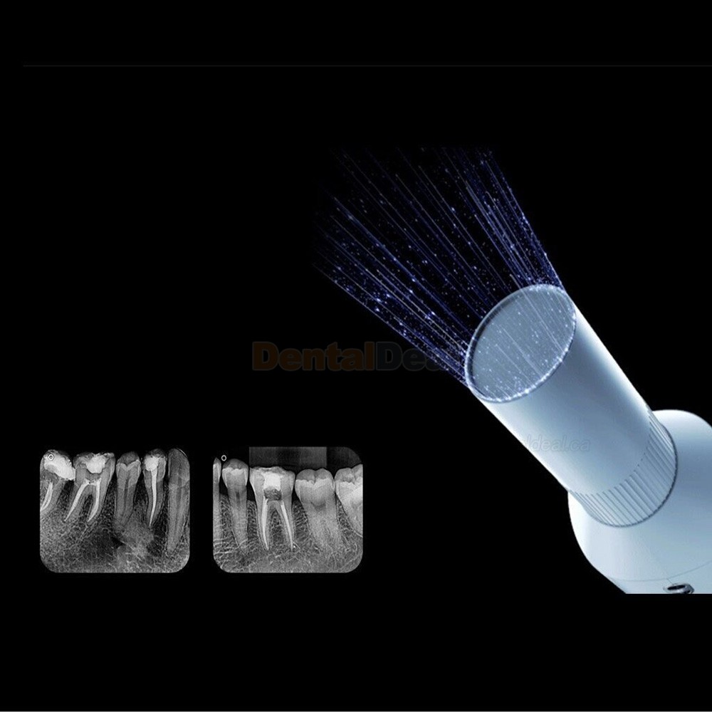 Woodpecker Ai Ray Handheld Portable Dental X-Ray Machine High Frequency