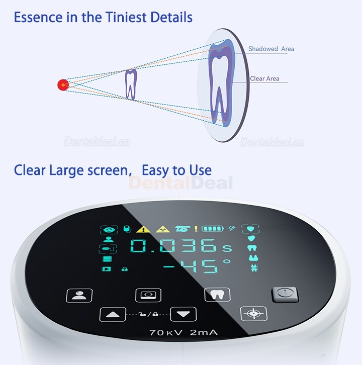 Woodpecker Mini Ray Portable Dental X-ray Machine Handheld Intraoral Imaging Unit