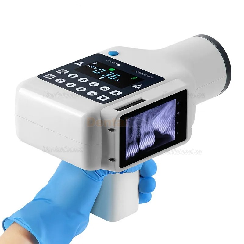 Portable Dental X-Ray Machine with Screen and Digital X-ray RVG Sensor