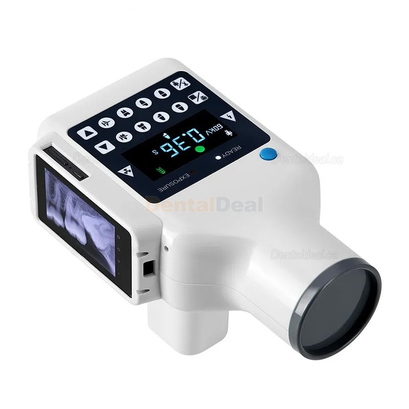 Portable Dental X-Ray Machine with Screen and Digital X-ray RVG Sensor