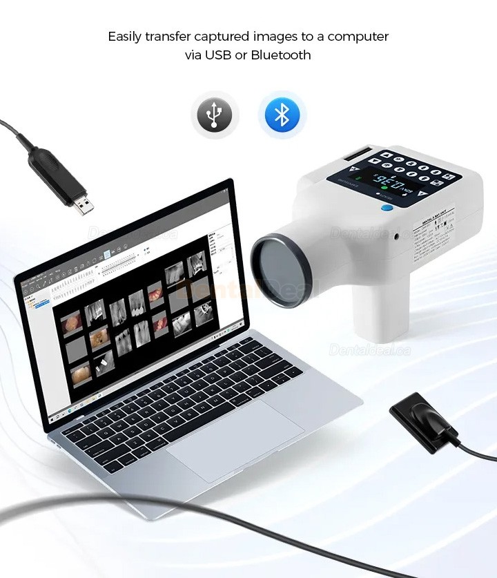 Portable Dental X-Ray Machine with Screen and Digital X-ray RVG Sensor