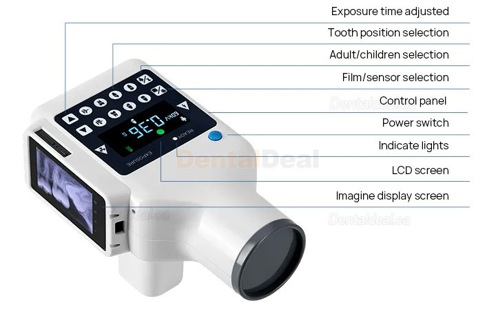 Portable Dental X-Ray Machine with Screen and Digital X-ray RVG Sensor