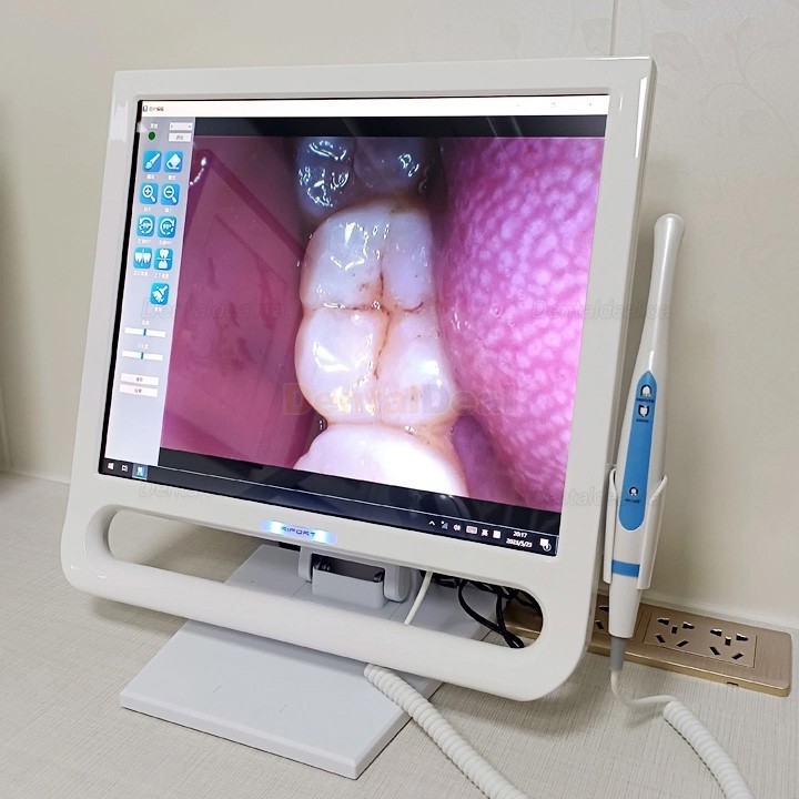 Magenta YF-1700P+ 17 Inch Touch Screen Intraoral Camera