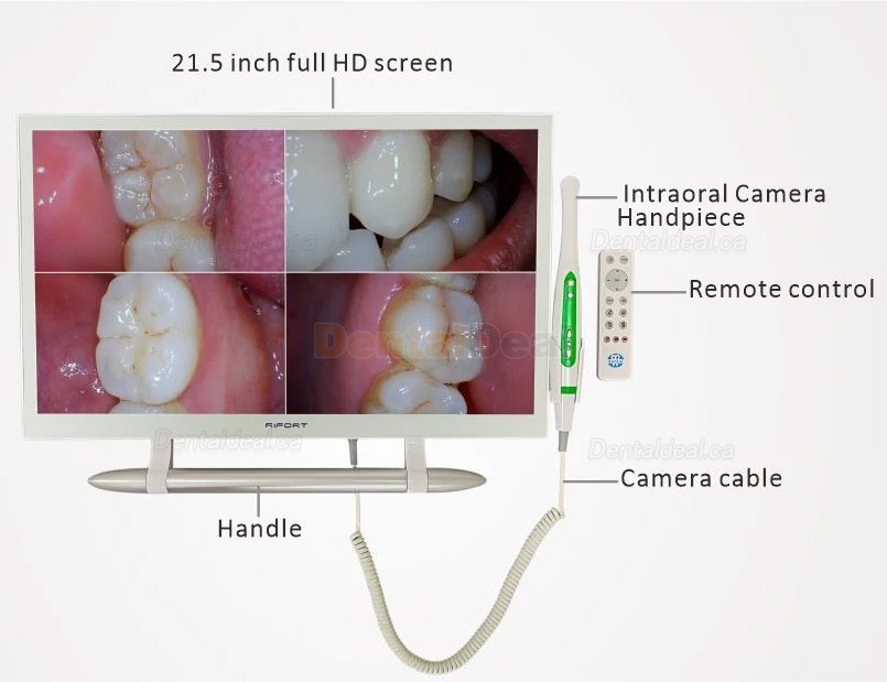 Magenta YF-2200M Intraoral Camera with Wifi and 21.5 Inch Monitor