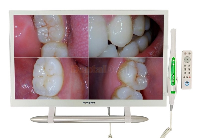 Magenta YF-2200M Intraoral Camera with Wifi and 21.5 Inch Monitor
