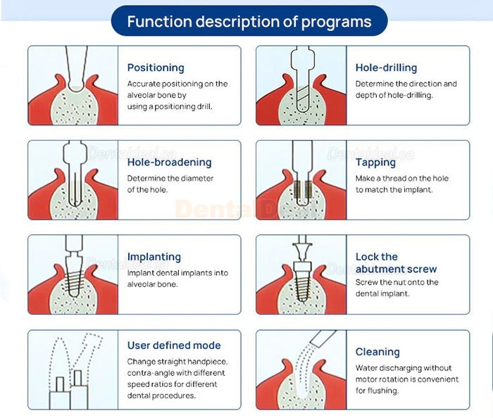 Yahope IMPLANT surg Dental Implant Surgical Motor