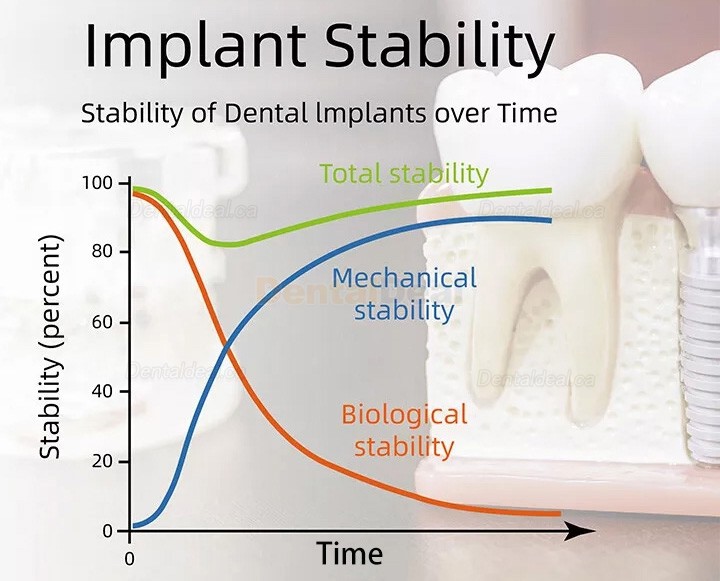 YAHOPE iCHECK Implant Stability Meter Dental Implant Tester ISQ Monitor
