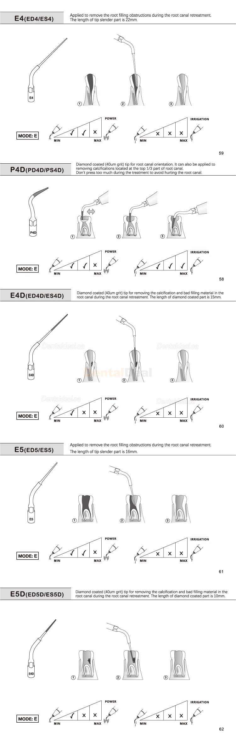 5Pcs Refine&reg; Endodontic Ultrasonic Tips E1 E2 E3 E4 E4 E6 E7 E8 E9 E10 E11 E14 E15 Fit EMS Mectron Woodpecker